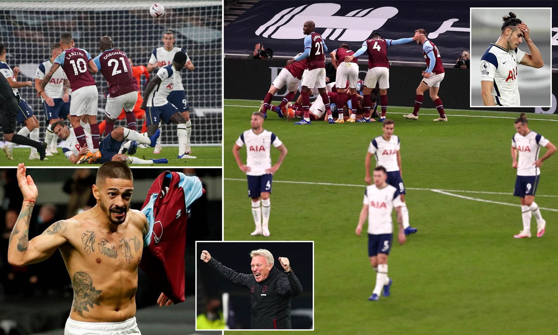 补以上肢快 补以上肢快